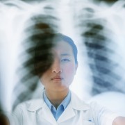 Seeking treatment for tuberculosis in Singapore