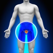 Prostate cancer cases rising amongst Western men