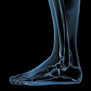 Organic response to treating orthopaedic injuries