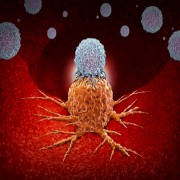 New immunotherapy hydrogel to treat cancer