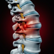 How have spinal surgeries become safer?